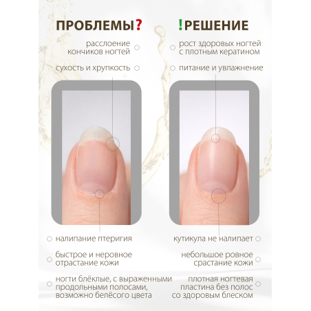 Купить масло для ногтей и кутикулы парфюмированное Barberry