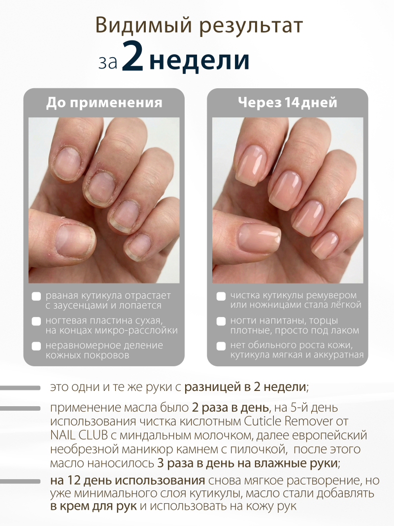 Купить масло для ногтей и кутикулы парфюмированное Bilberry Mousse